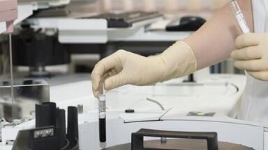 Can Chromatography Help Us Detect Cancer Earlier?
