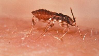 What is Chagas Disease and How Can Chromatography Help?