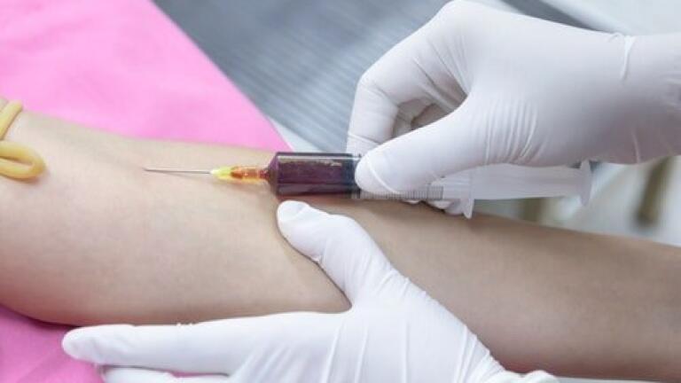 Chromatography Analyses the Lifespan of Human Plasma