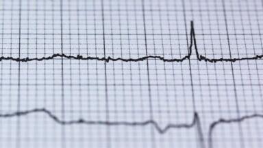 Do Melatonin Levels Affect Pulmonary Arterial Hypertension? - Chromatography Investigates