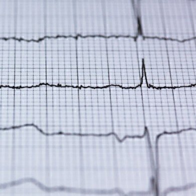 Do Melatonin Levels Affect Pulmonary Arterial Hypertension? - Chromatography Investigates