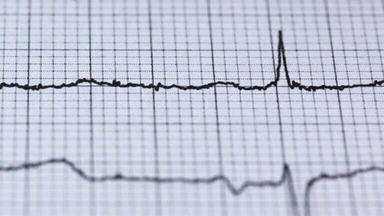 Do Melatonin Levels Affect Pulmonary Arterial Hypertension? - Chromatography Investigates