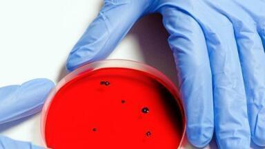 What's the Best Way to Detect Mycotoxins in Food?