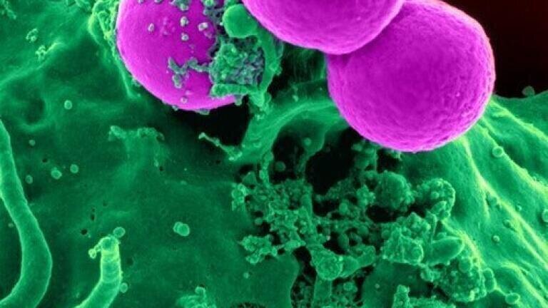 How Does the Human B Cell React to Sars-COV-2?