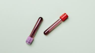 5 Applications of Gas Chromatography