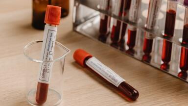 Why is Sample Preparation Important?