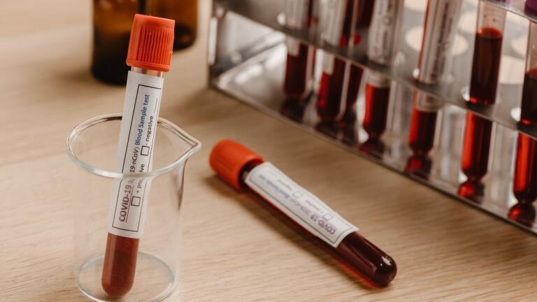 Why is Sample Preparation Important?