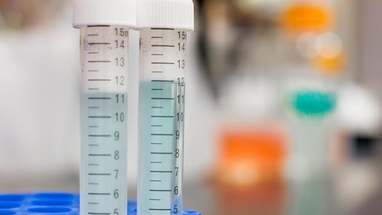 5 Characteristics of a Good Gas Chromatography Detector