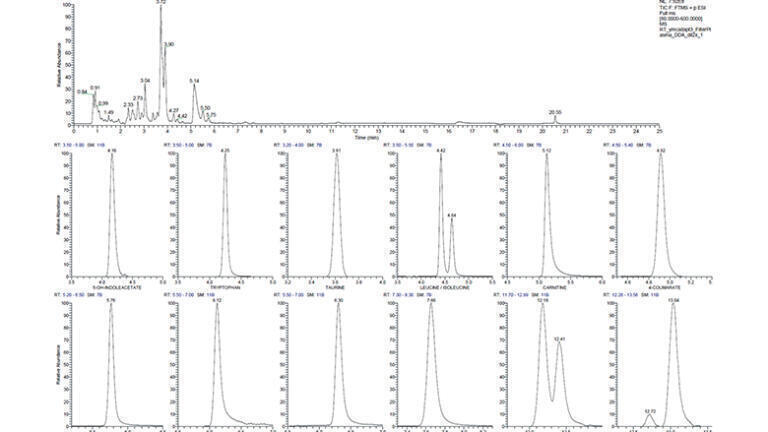 Figure 3: Non-targeted HRMS analysis of human plasma: total ion current of the plasma sample (top) and selected ion chromatograms of annotated metabolites < 5 ppm (bottom).