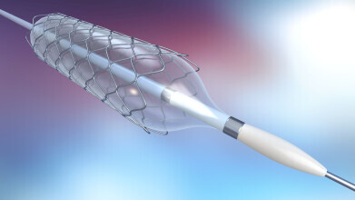 Advancing stent surface metallurgy monitoring