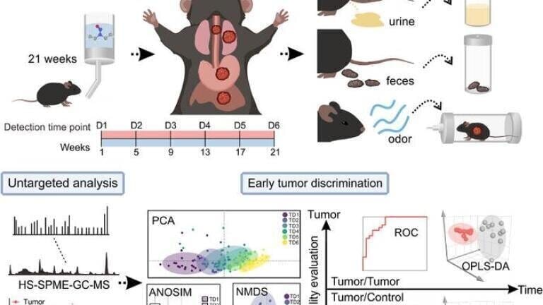 Schematic diagram of esophageal cancer cell identification research process. Credit GE Dianlong