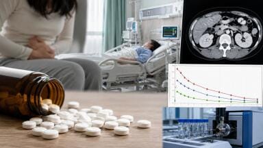 Journal Watch: Loxoprofen overdose without toxicity: analysis of loxoprofen pharmacokinetics through use of LC–MS
