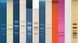 Analysis of Phospholipids by HPTLC