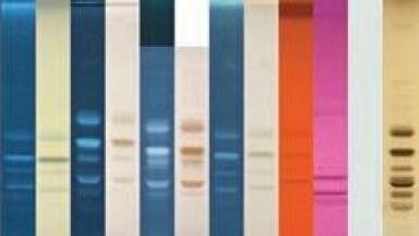 Analysis of Phospholipids by HPTLC